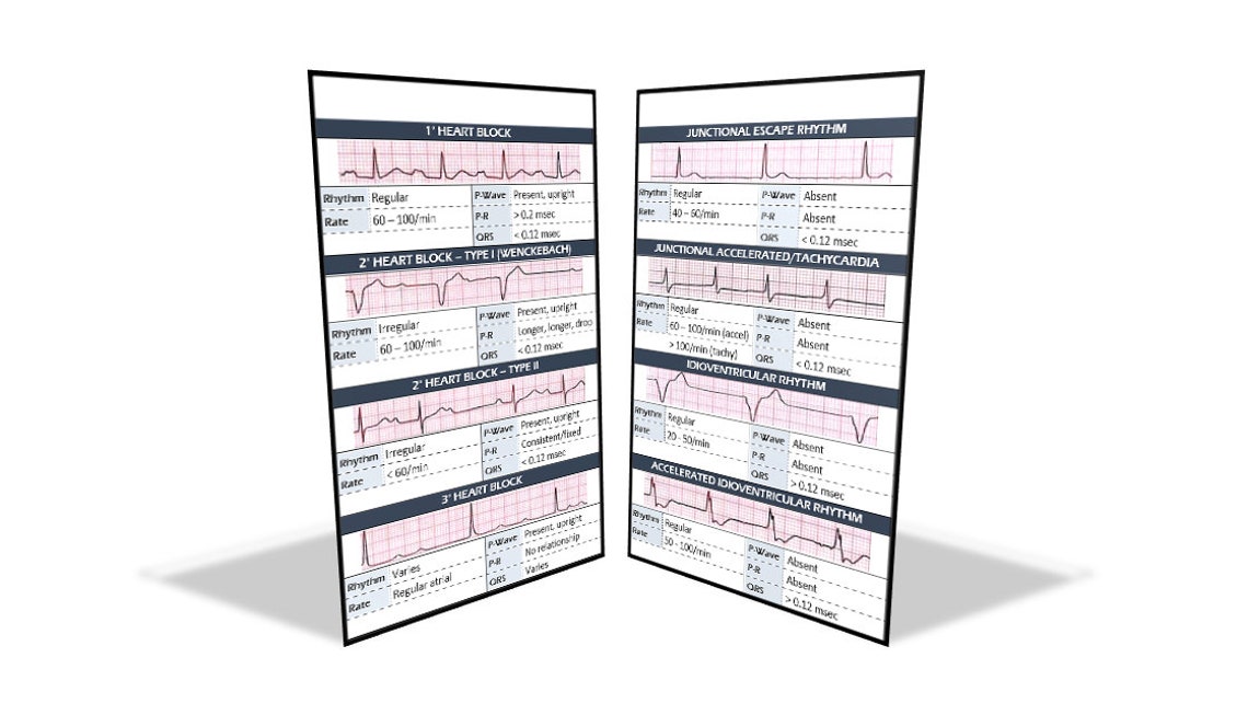 EKG Interpretation Digital Download Badge Buddy - Etsy