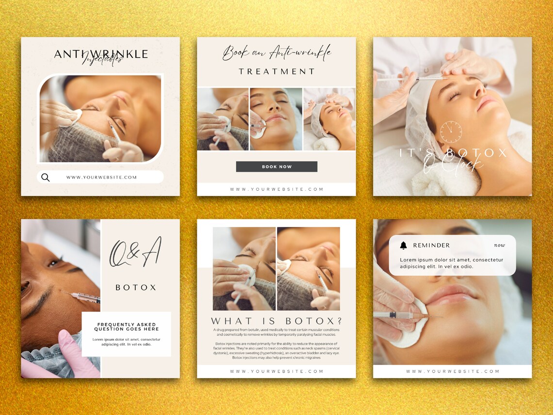 Botox and Lip Filler Instagram Template | Botox Instagram Posts | Botox ...