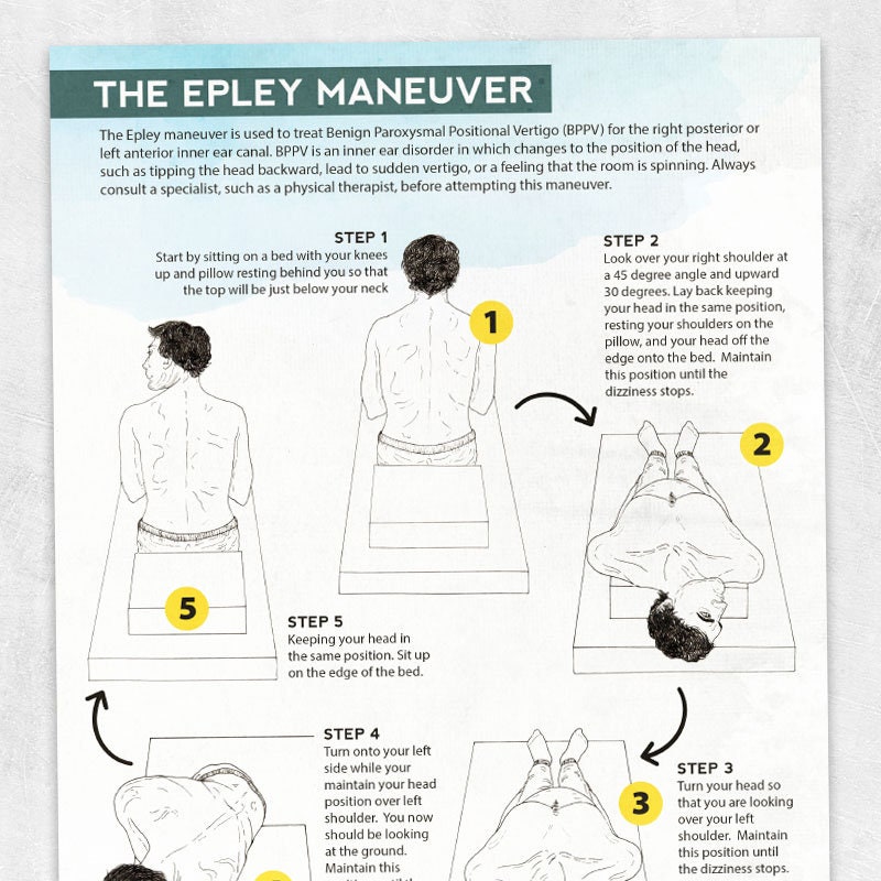 Epley maneuver illustration