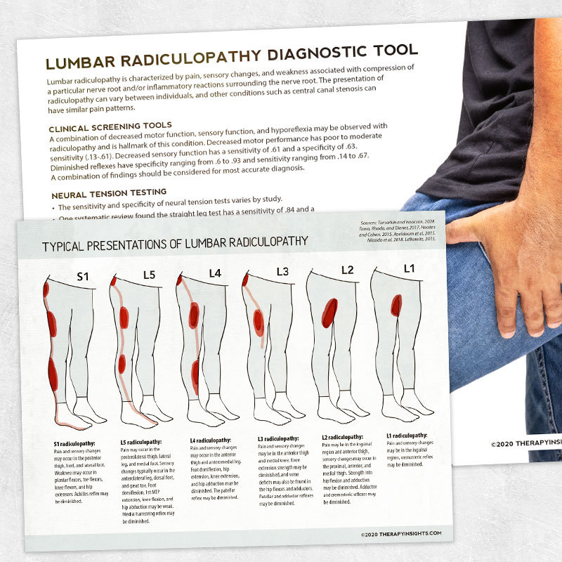 Printable resource lumbar radiculopathy typical presentations by level