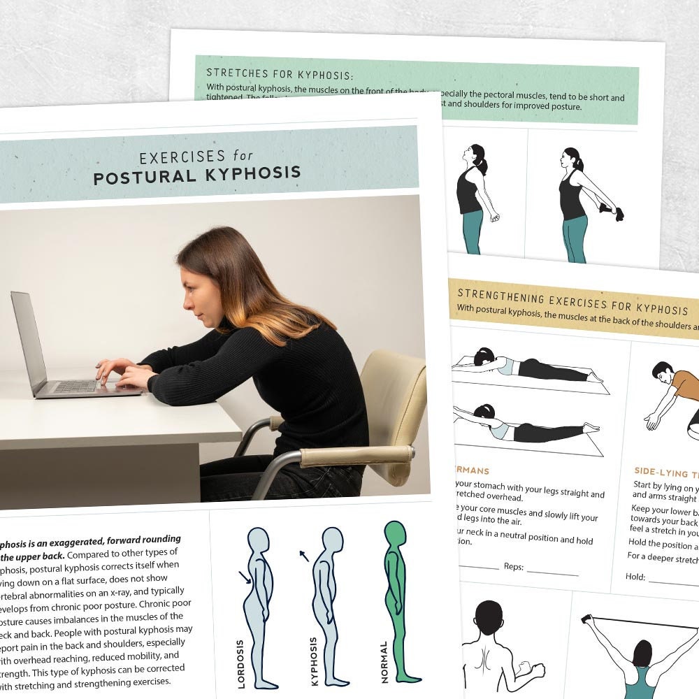Kyphosis stretch new arrivals