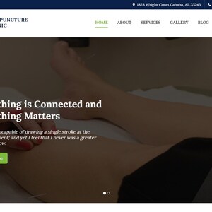 May include: A person receiving acupuncture treatment. The image shows a close-up of a leg with needles inserted into the skin. The text on the website reads "Everything is Connected and Everything Matters".