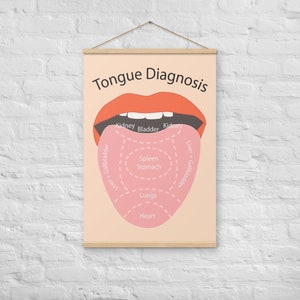 Acupuncture Tongue Chart