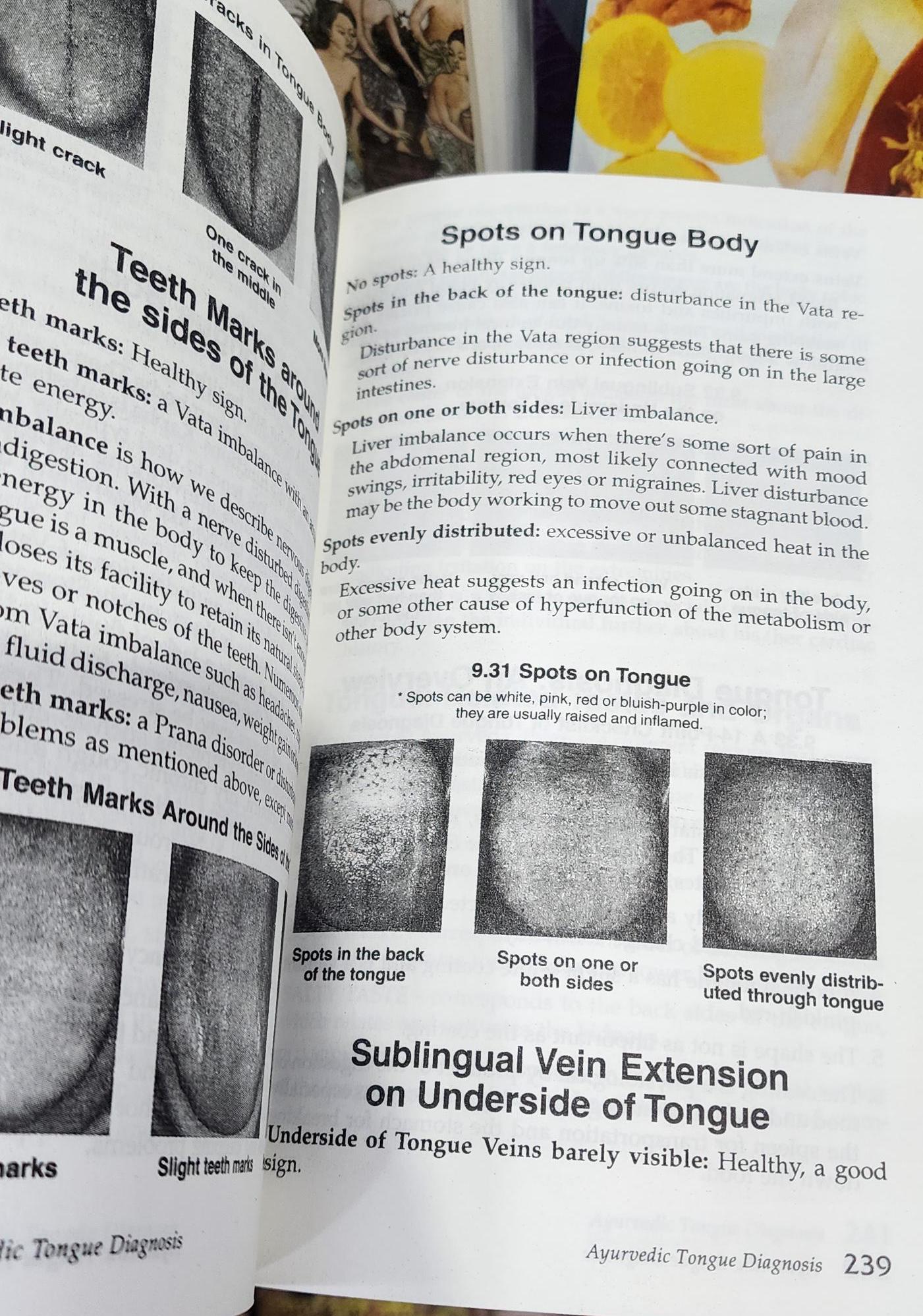 アーユルヴェーダ舌診断 - Etsy 日本