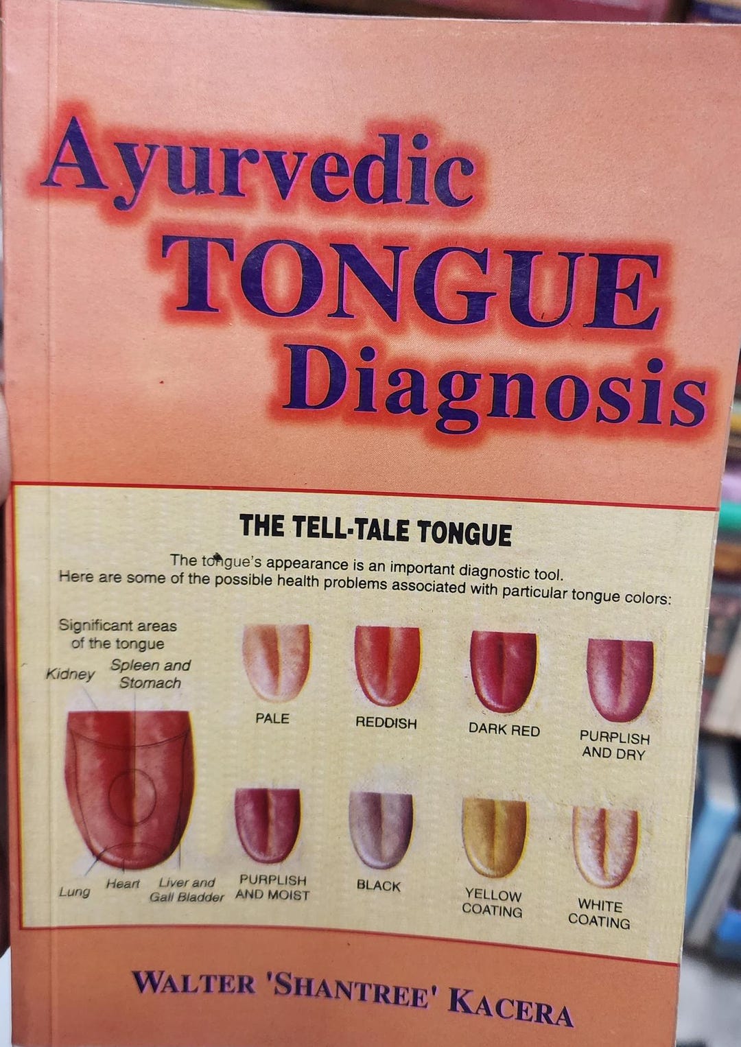 Ayurvedic Tongue Diagnosis Etsy