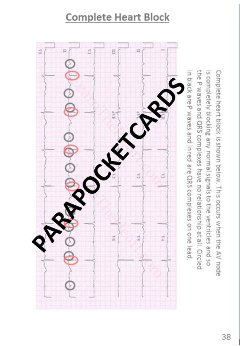 Student Paramedic Pocket Cards Digital - Etsy