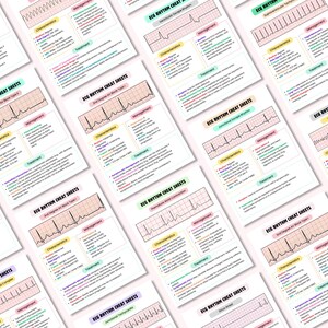 May include: A set of 10 printable ECG rhythm cheat sheets with different heart rhythms, characteristics, management, and treatment information. Each sheet features a pink and white grid with a black and white EKG waveform.