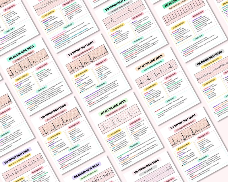 May include: A set of 10 printable ECG rhythm cheat sheets with different heart rhythms, characteristics, management, and treatment information. Each sheet features a pink and white grid with a black and white ECG waveform.