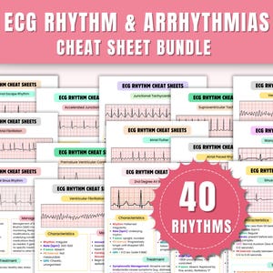 Cheatsheetbundel ECG-ritme en aritmieën | Cheatsheet ECG | ECG-studiegids | Verplegingsnotities | Hartverpleging | 40+ ritmes