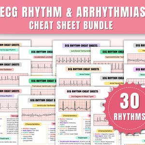 Cheatsheet voor ECG-ritme en aritmieën | ECG-studiegids | Verplegingsnotities