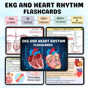 150+ EKG und Herzrhythmus Karteikarten | EKG Studienführer | EKG oder Ekg Interpretation | Cardiac Studienführer | Ekg rhythms | Pflegehinweise