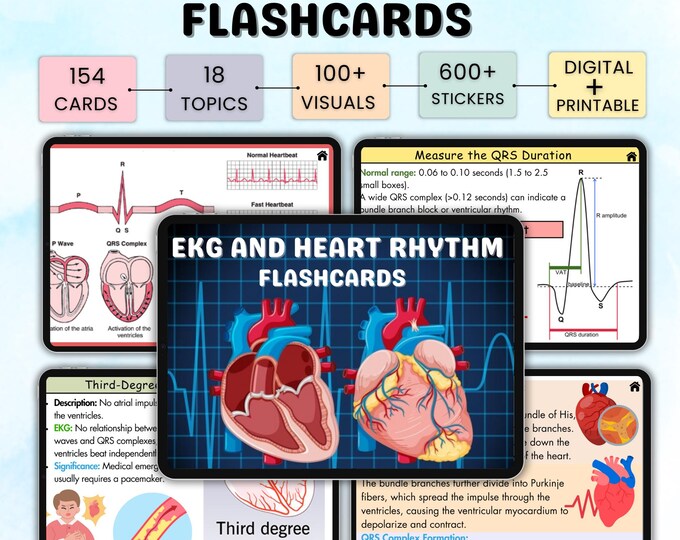 Cardiac Rhythm Examples - Etsy