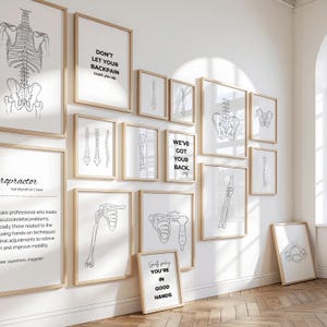 Op de afbeelding: Een verzameling ingelijste kunstafdrukken met skeletillustraties en motiverende citaten. De afdrukken zijn in zwart en wit, met houten frames. De citaten zijn onder meer "DON'T LET YOUR BACKPAIN crack you up" en "WE'VE GOT YOUR BACK."