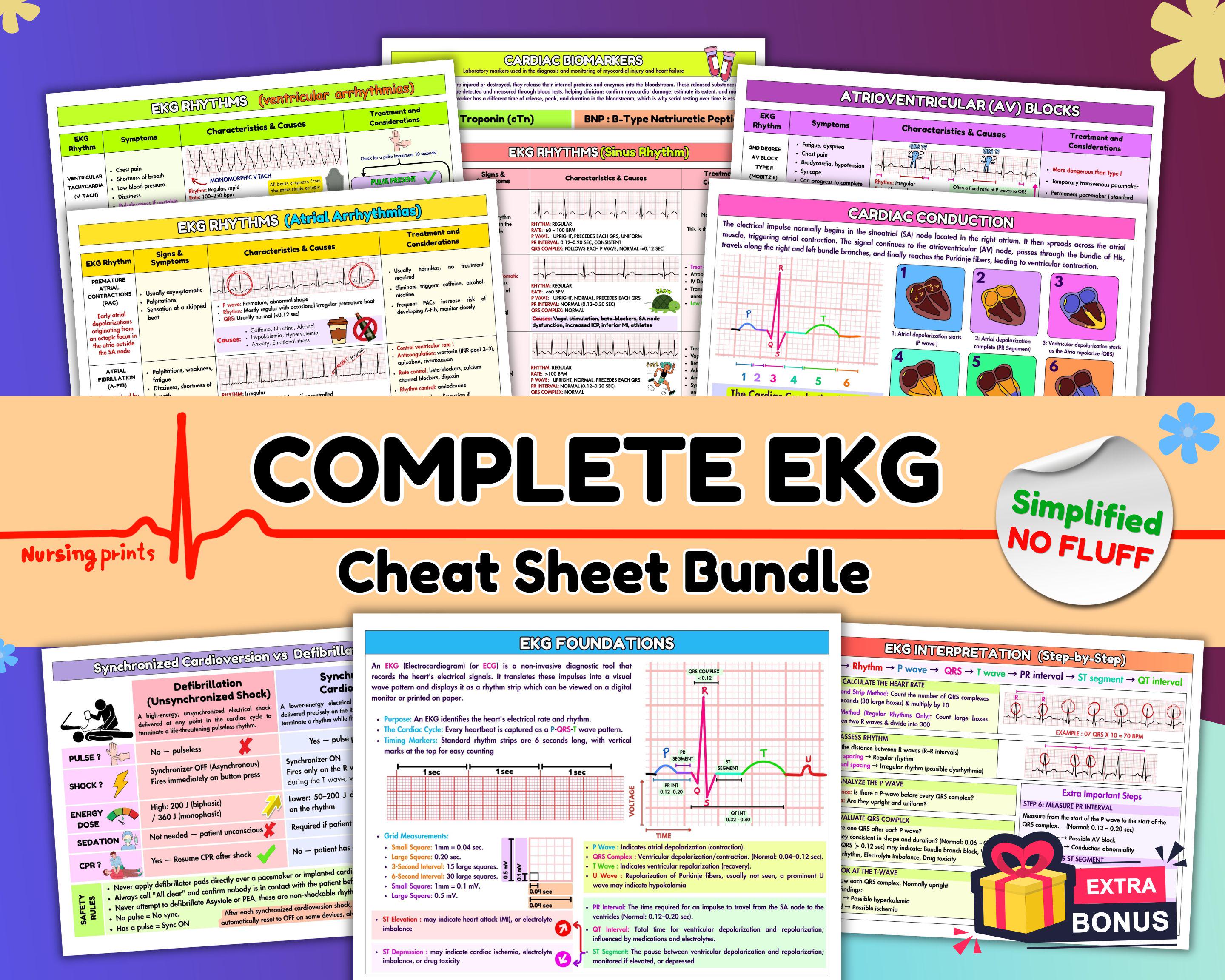 Ecg Notes Rhythms EKG Rhythms & Dysrhythmia Cheat Sheet Bundle, Nursing School Study ...
