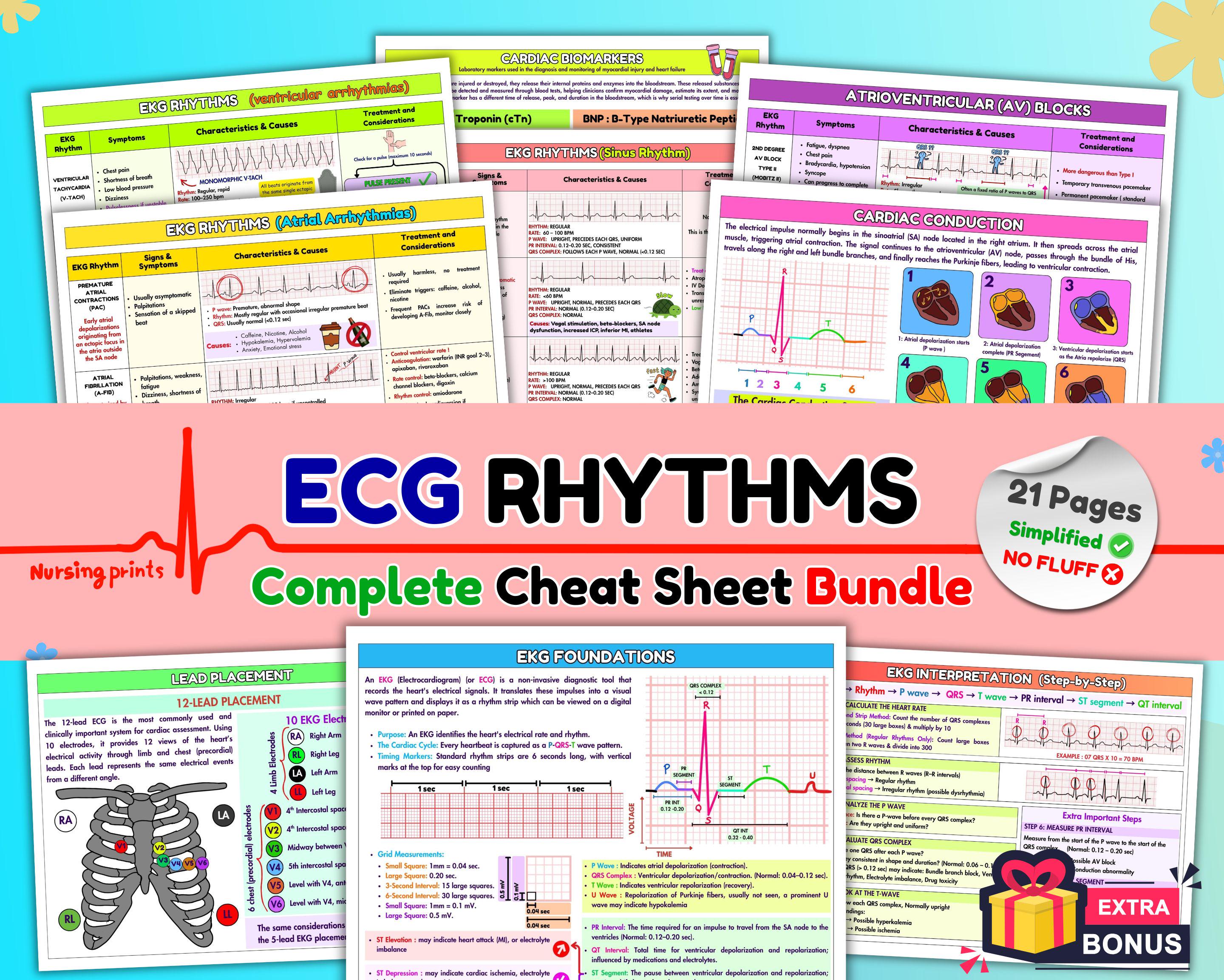 Ecg Notes Rhythms EKG Rhythms & Dysrhythmia Cheat Sheet Bundle, Nursing School Study ...