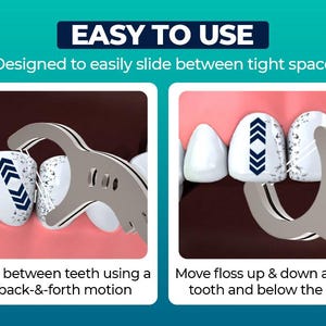 以下が含まれることがあります： 歯の間を掃除するためにデンタルフロスツールを使用する方法を示すイラスト。ツールは、2 本の歯の間をフロスで滑らせるために、優しく前後に動かす方法で示されています。2 番目の画像は、ツールを歯に沿って上下に動かし、歯茎のラインの下に動かす方法を示しています。