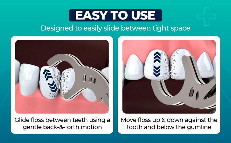 以下が含まれることがあります： 歯の間を掃除するためにデンタルフロスツールを使用する方法を示すイラスト。ツールは、2 本の歯の間をフロスで滑らせるために、優しく前後に動かす方法で示されています。2 番目の画像は、ツールを歯に沿って上下に動かし、歯茎のラインの下に動かす方法を示しています。