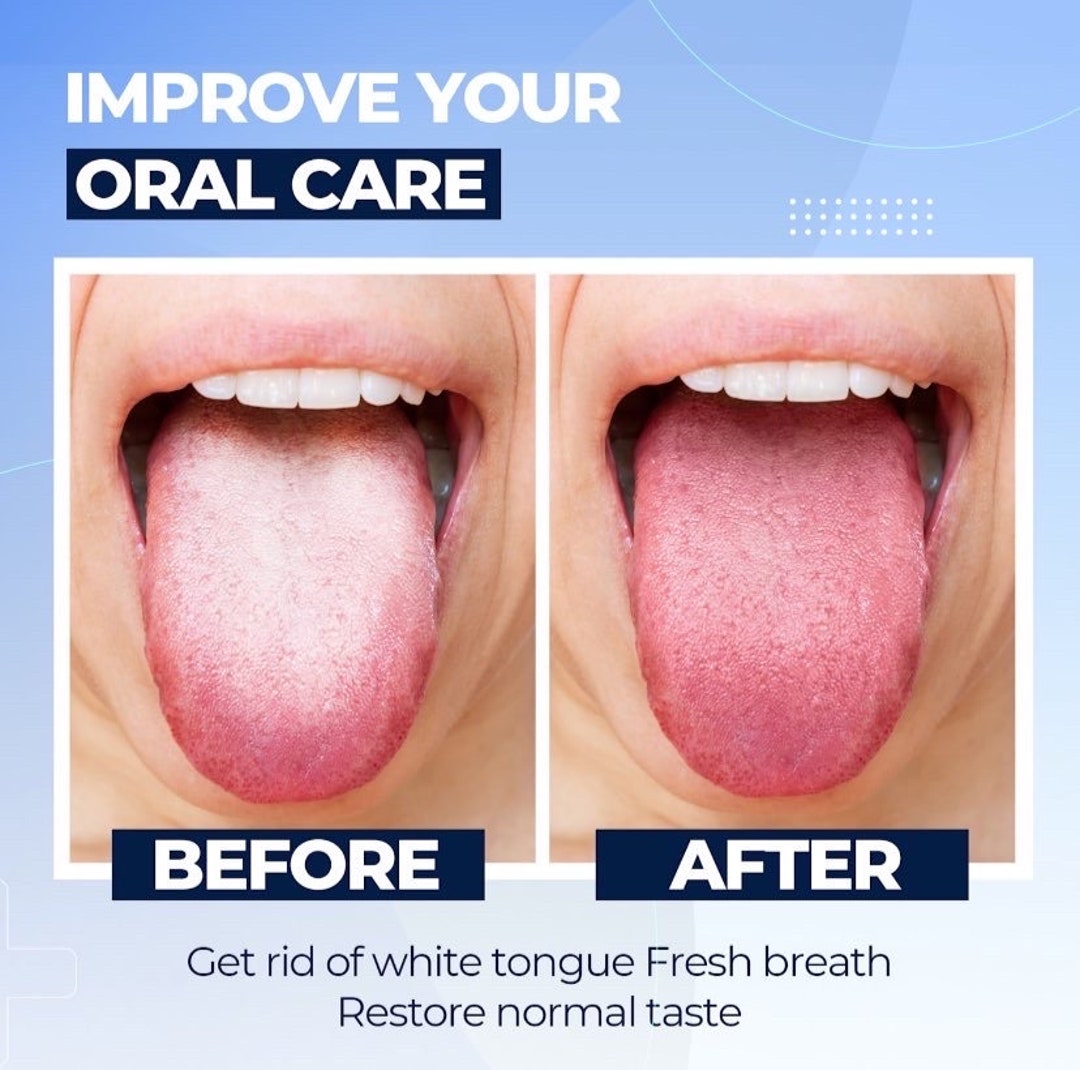 Doubleended Tongue Scraper Serrated Edge for Deep Cleaning Bad