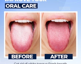 Double-Ended Tongue Scraper Serrated Edge for Deep Cleaning Bad Breath(2pack)