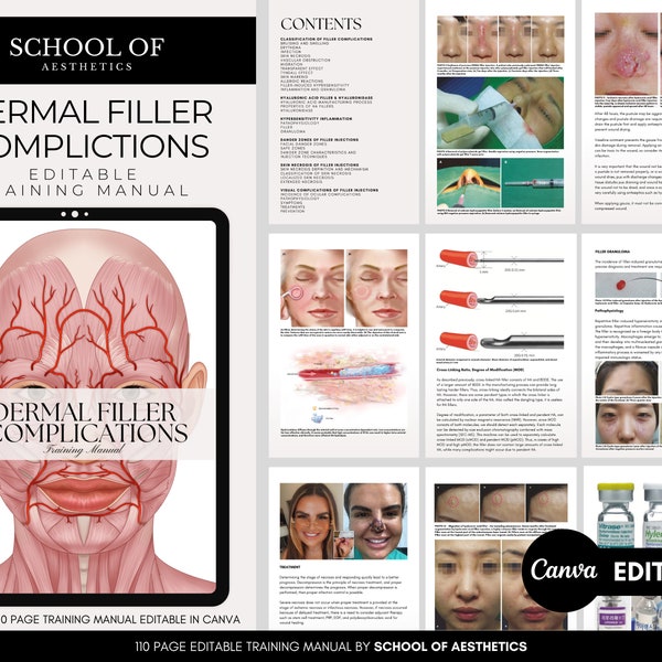 Dermal Filler Complications Training Manual, Hyaluronic Acid Complications, Dermal Fillers Injection Problems, Aesthetic Complications eBook