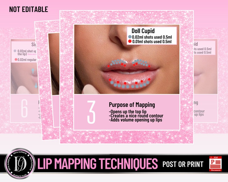 Hyaluron Pen Lip Mapping Lip Maps Guide Lip Mapping Etsy Finland