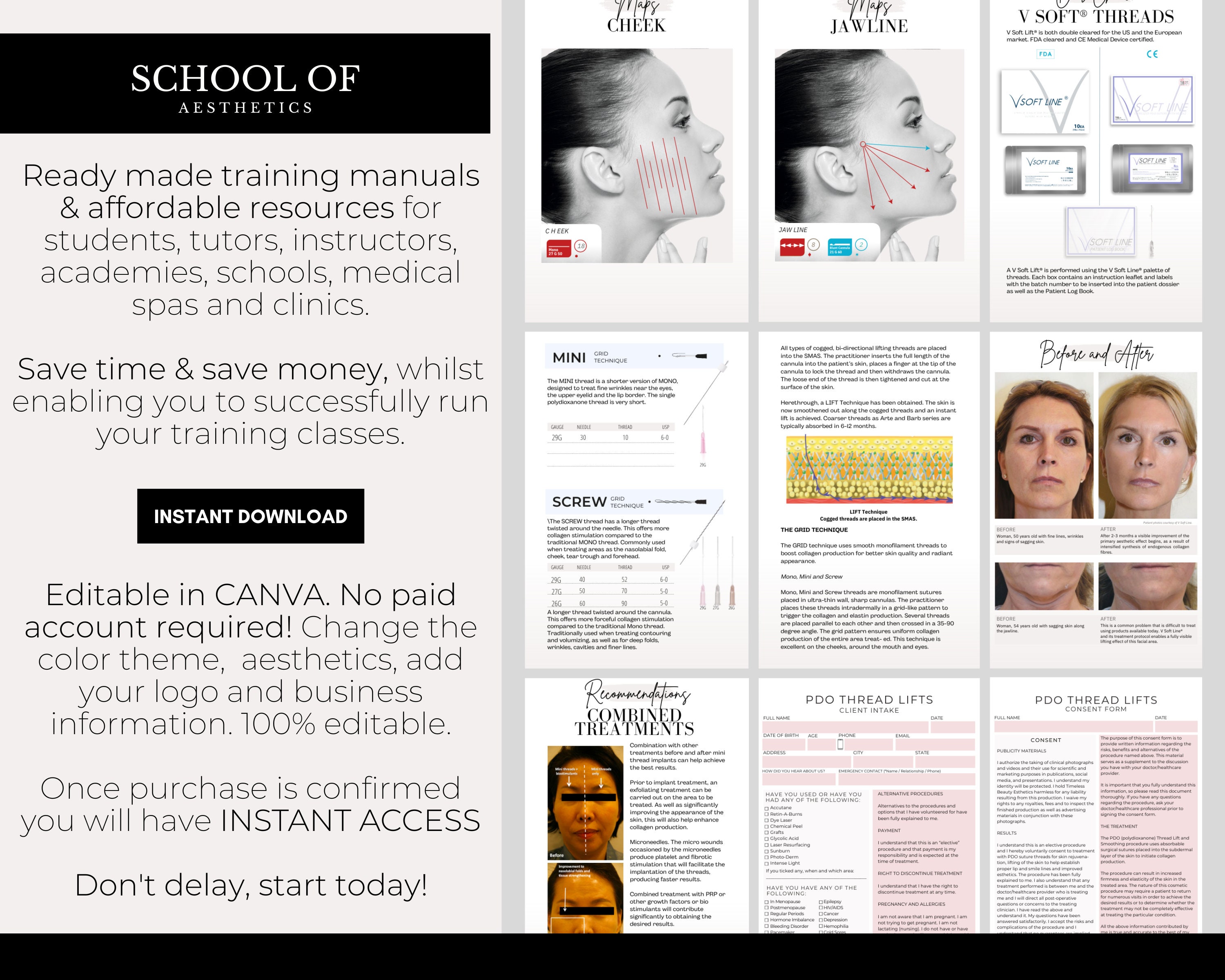 PDO Threads Training Manual, PDO Thread Lift Procedures, PDO Thread