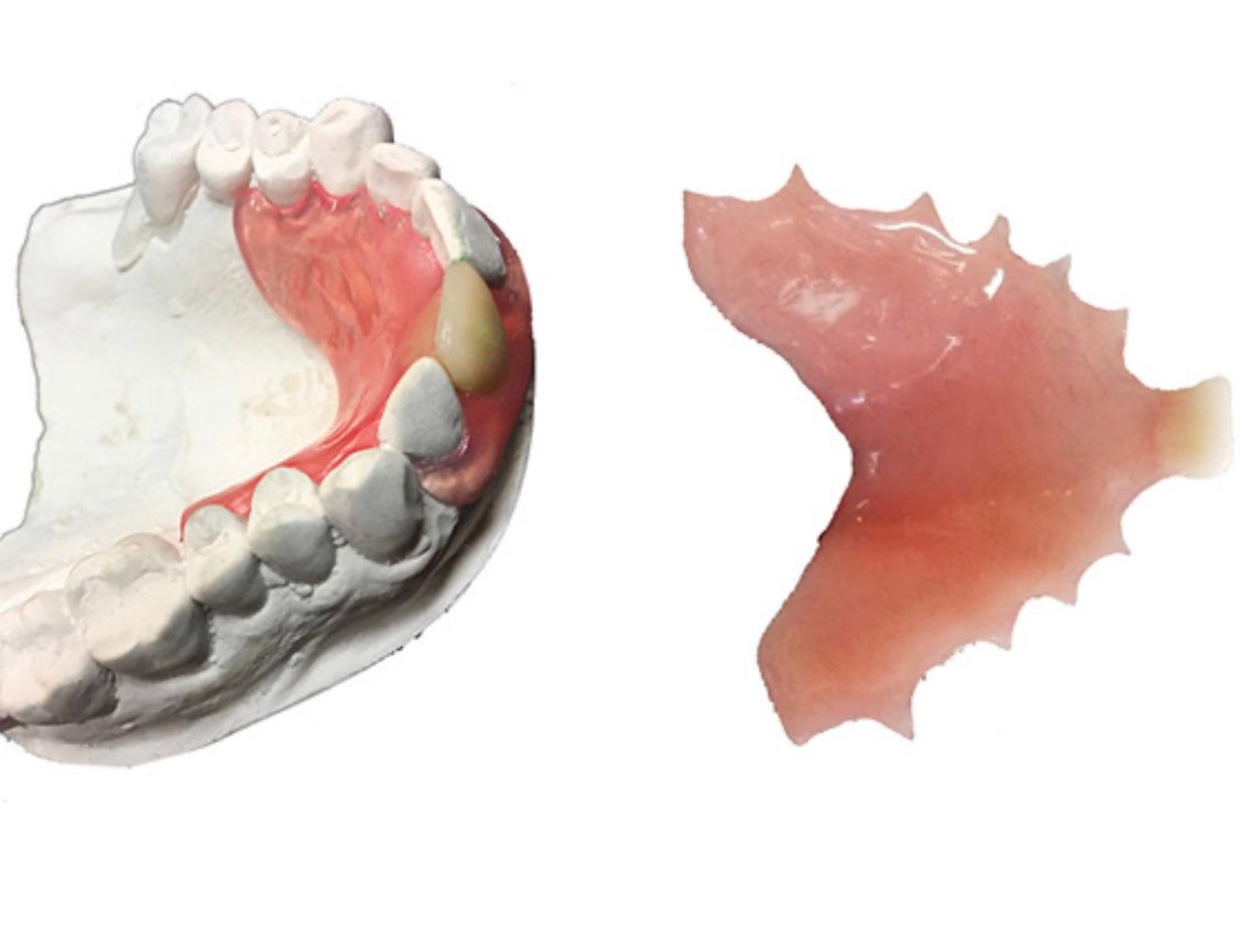 Flipper Denture Appliance Etsy