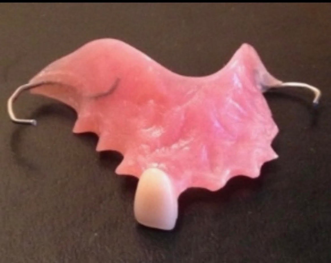Flipper Denture Appliance Etsy