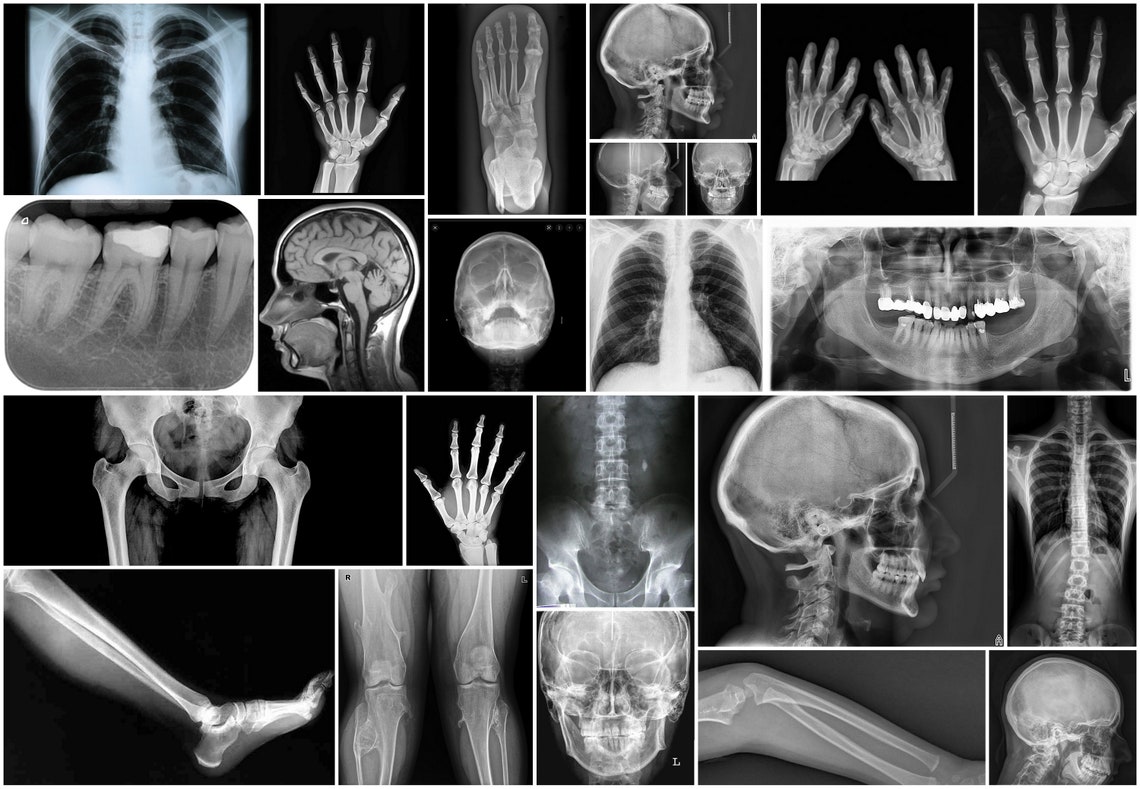 X Ray Files Instant Downloads. Printable Tags Pages Paper Craft Etsy