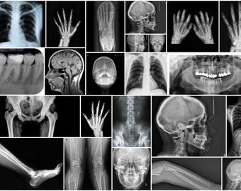 May include: A collection of medical x-ray images showing various parts of the human body, including the chest, hands, skull, teeth, spine, and legs.