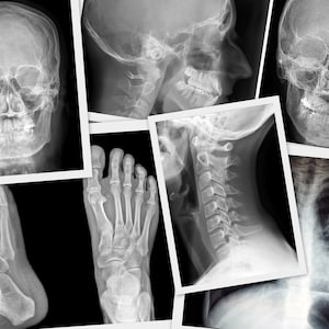 X ray  100 files Instant Downloads. Printable Tags Pages Paper Craft