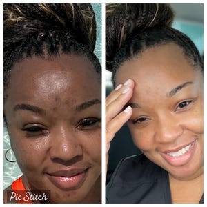Barra facial/corporal SaraBale Turmeric & Kojic Powder
