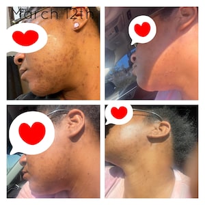 SaraBale Turmeric & Kojic Powder Face/Body Bar image 8