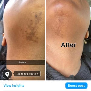 SaraBale Turmeric & Kojic Powder Face/Body Bar image 7