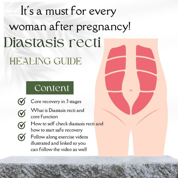 Guide de récupération de diastasis recti, récupération de base