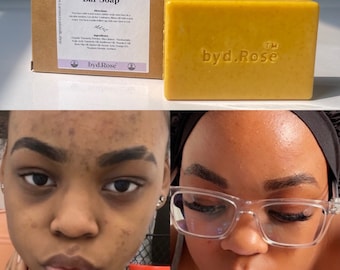 Wholesale/Bulk Turmeric Kojic Acid Bar Soap (Glow N Bar Soap)