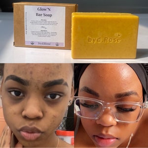 Turmeric Kojic Acid Soap ( Glow’N Bar Soap)