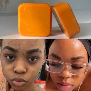 Sample Size Turmeric Kojic Acid Soap GlowN Bar Soap Sample Sample Size image 1