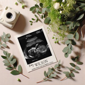 May include: A framed ultrasound image of a baby with the text "Baby Wilson Arriving December 2024" below the image. The image is surrounded by green eucalyptus leaves and white flowers.