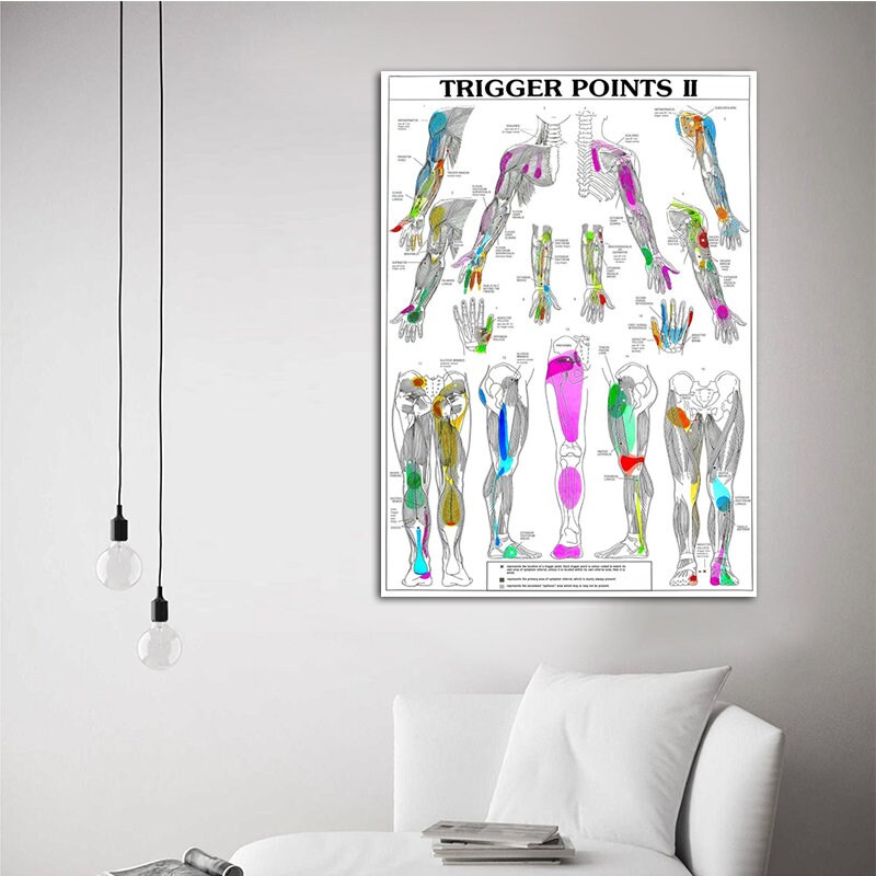 Trigger Points Chart Informational Anatomy Oil Canvas Print Painting Wall Art Poster Hangers ...