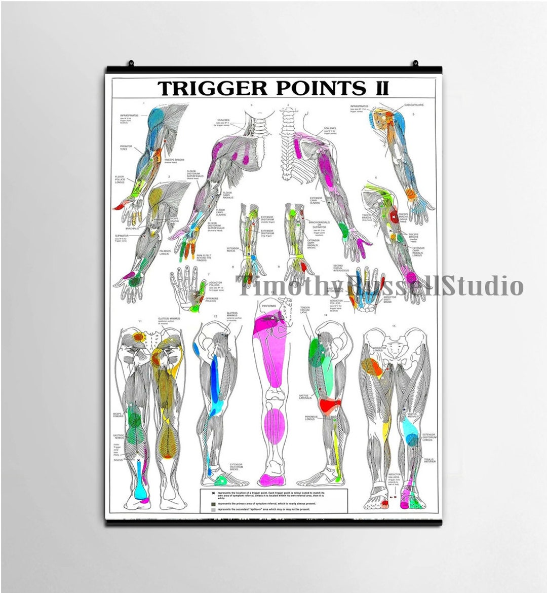 Trigger Points Chart Informational Anatomy Oil Canvas Print Painting Wall Art Poster Hangers ...