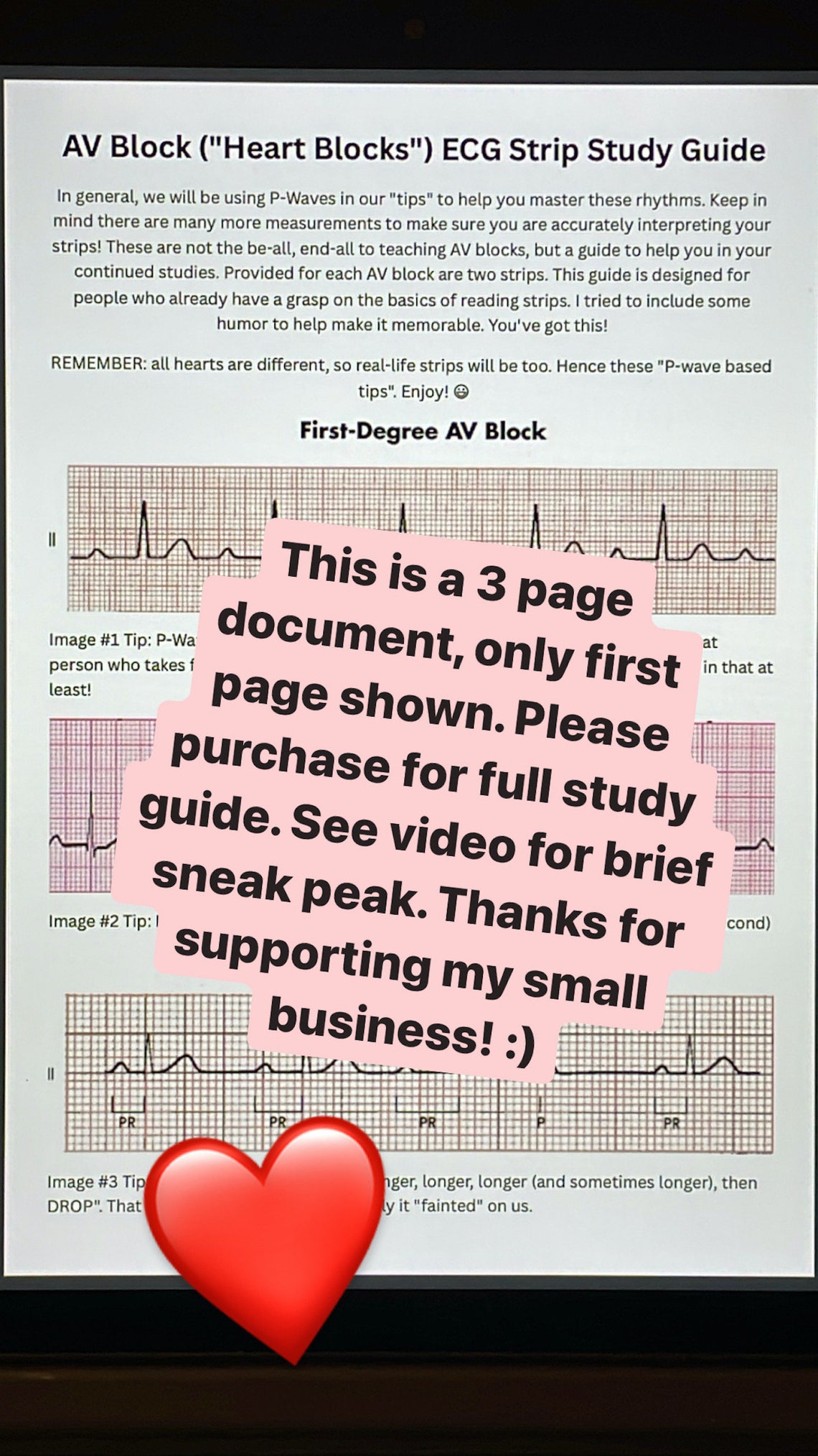 ECG/EKG AV Block heart Block Study Guide With Rhythm Strips Etsy