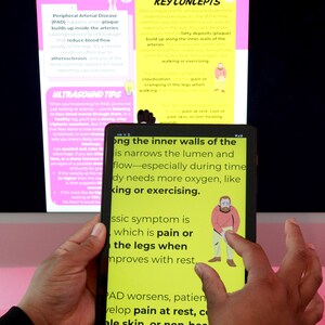 May include: A person holding a tablet displaying medical information about Peripheral Arterial Disease (PAD). The tablet screen shows text and an illustration of a person. A computer monitor and a box are in the background.