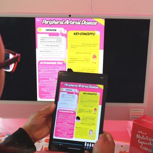 May include: A person wearing glasses is looking at a computer monitor and a tablet displaying information about Peripheral Arterial Disease. The monitor and tablet show text and graphics in pink, yellow, and white.