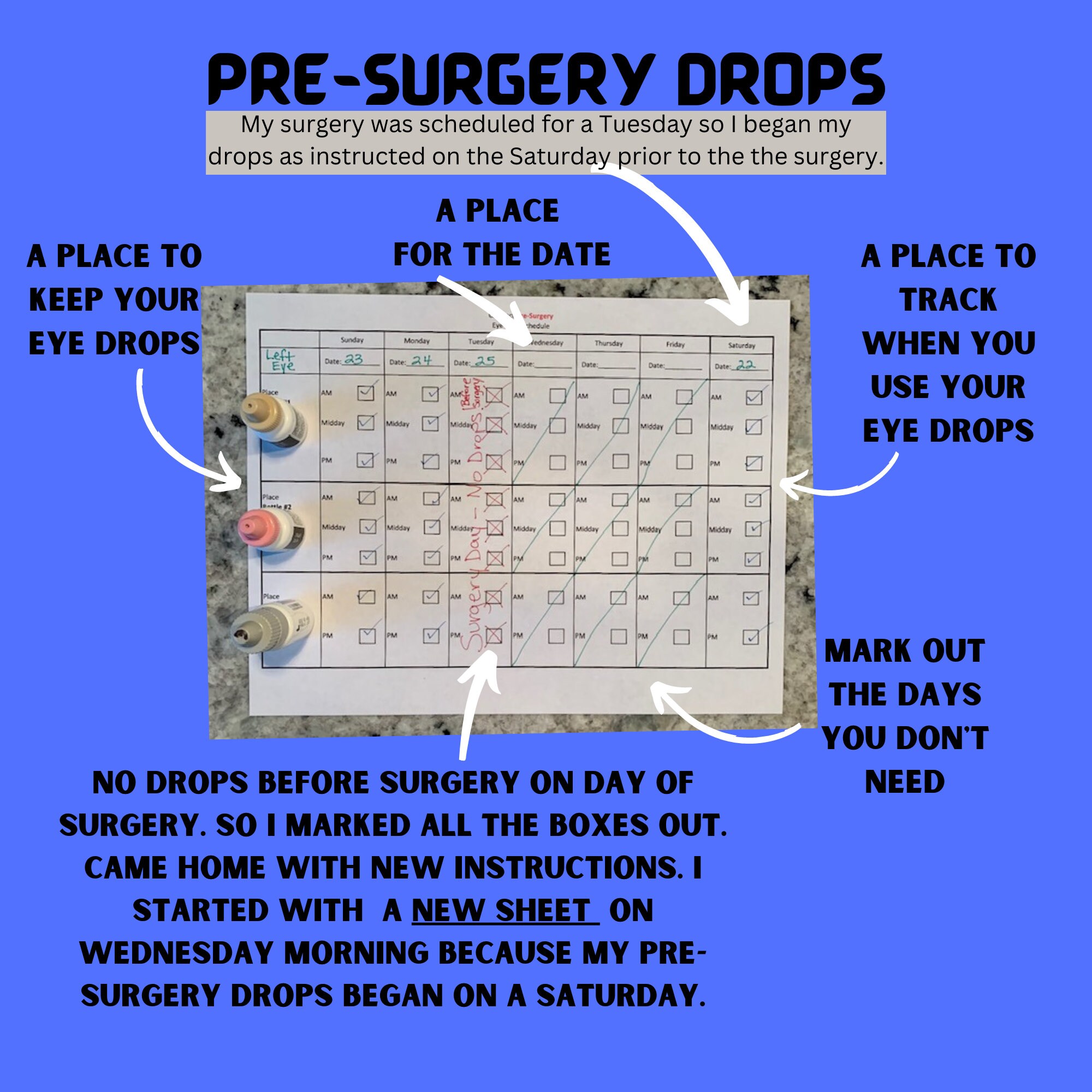 Cataract Surgery Eye Drop Tracker Eye Drop Schedule For Cataract cataract-surgery-eye-drop-tracker-eye-drop-schedule-for-cataract