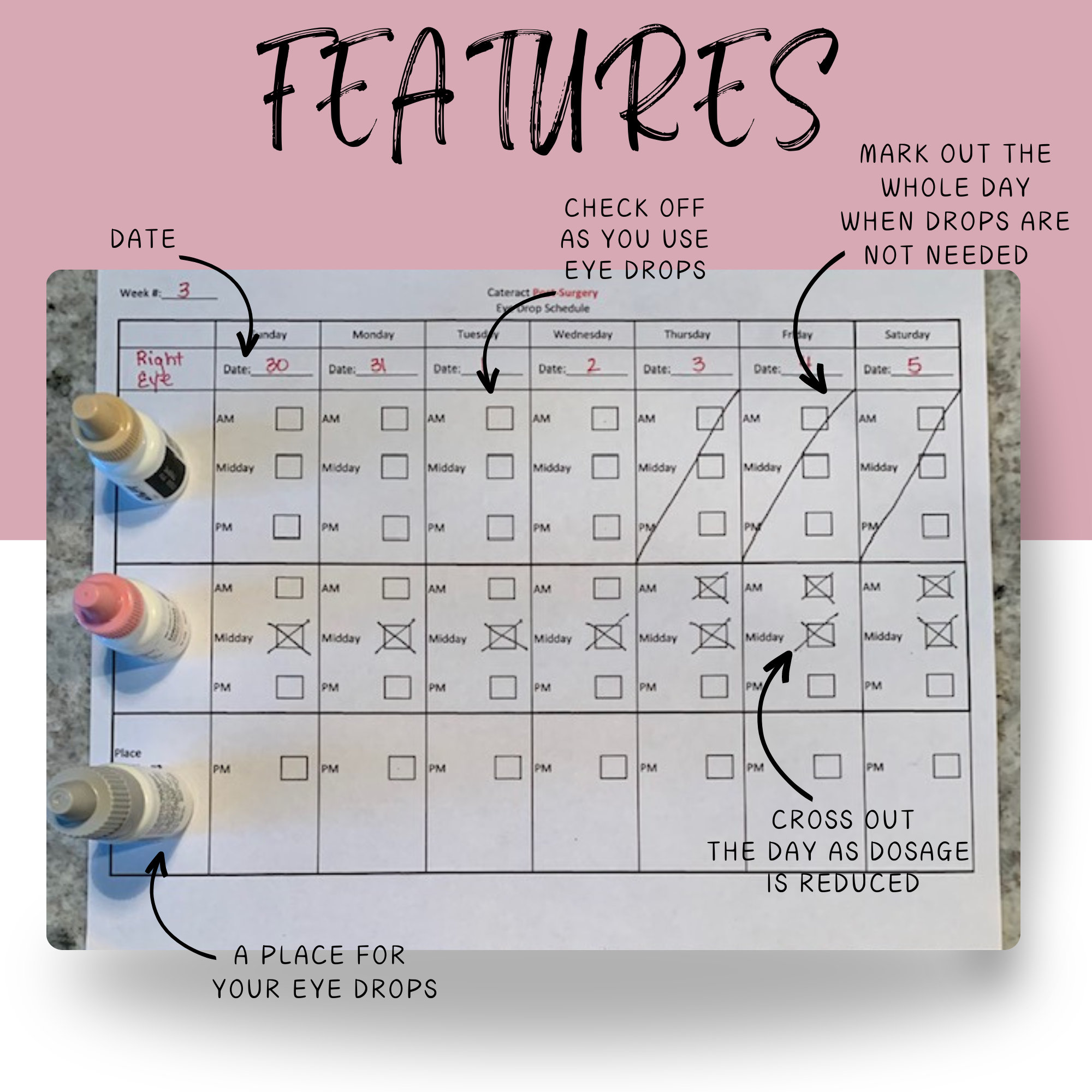 cataract-eye-drop-schedule-for-cataract-surgery-medication-tracker-eye