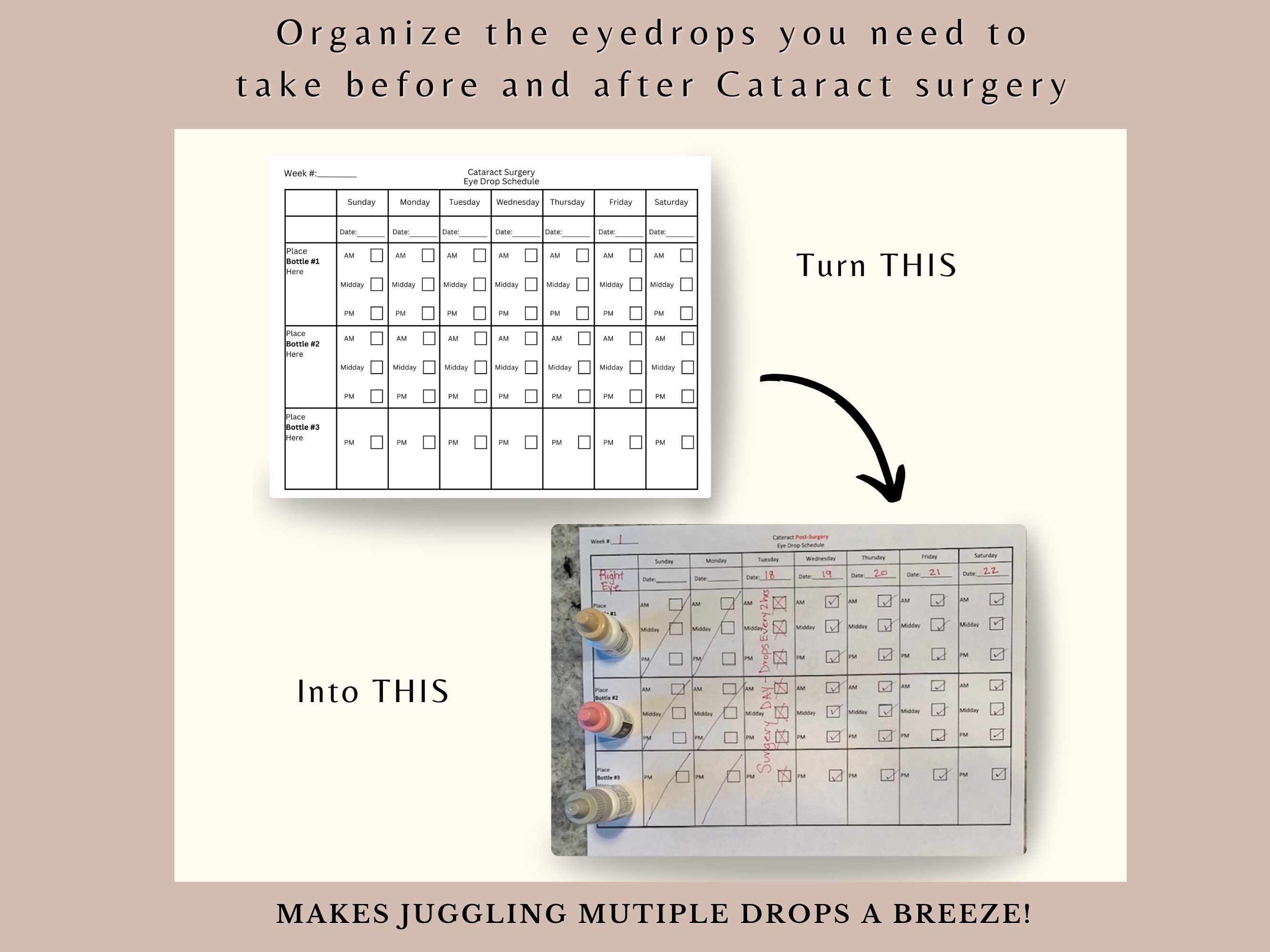 Cataract Eye Drop Schedule