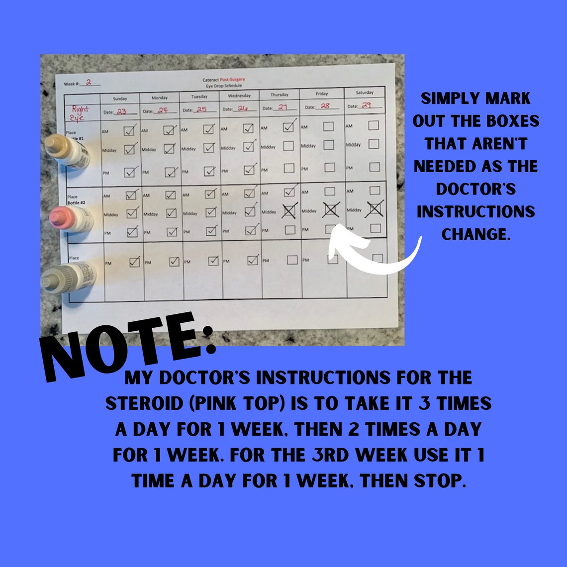 Cataract Surgery Eye Drop Tracker Eye Drop Schedule for Etsy