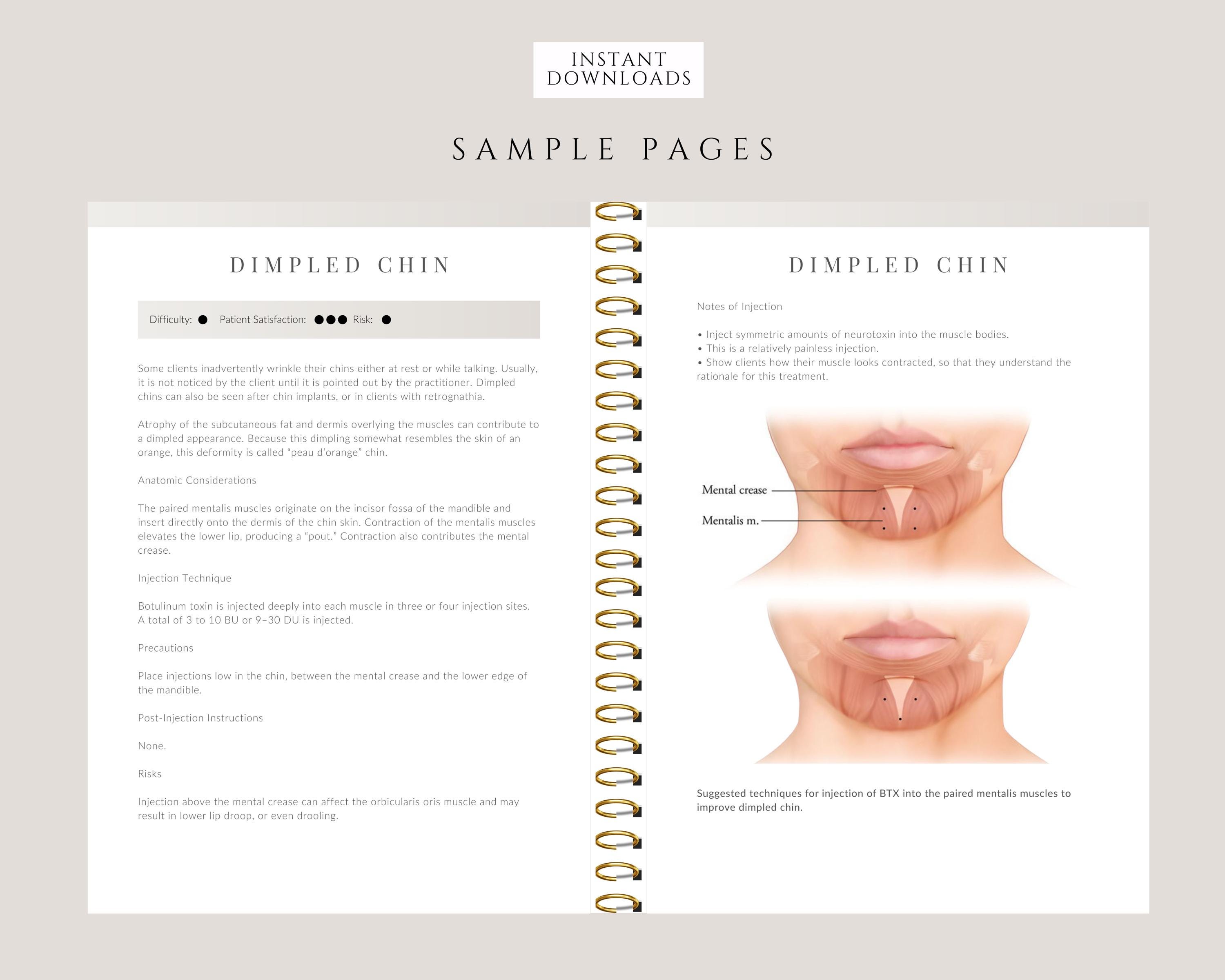 Botox Tutorial Botulinum Toxins Training Manual: Complete Step-by-step Botox Guide ...