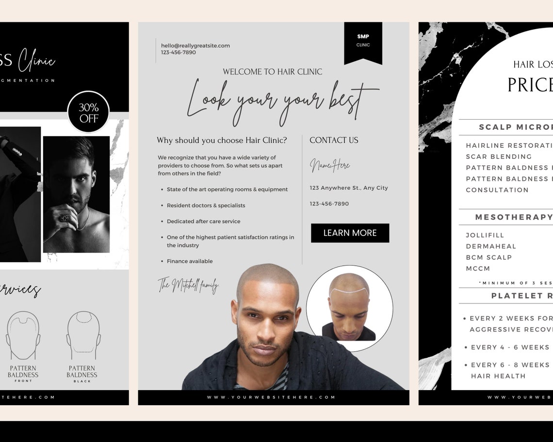 SMP Ads, DIY SMP Flyer, Scalp Micropigmentation Flyer Templates Design ...